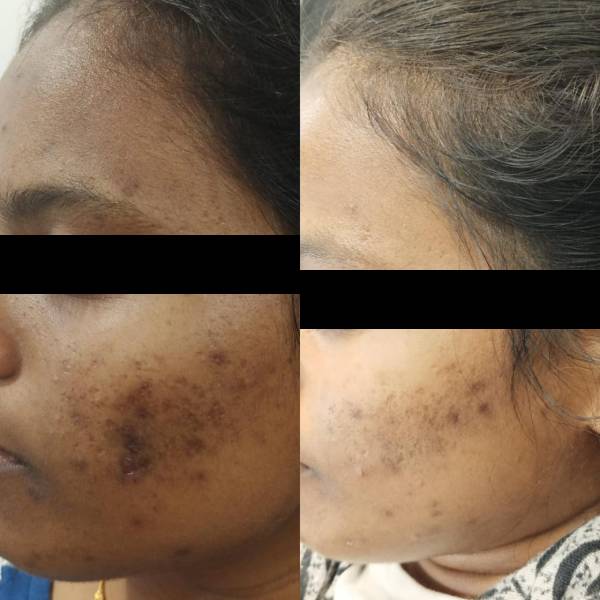 before-after-2
