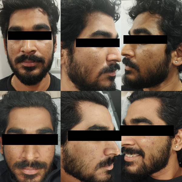 before-after-4