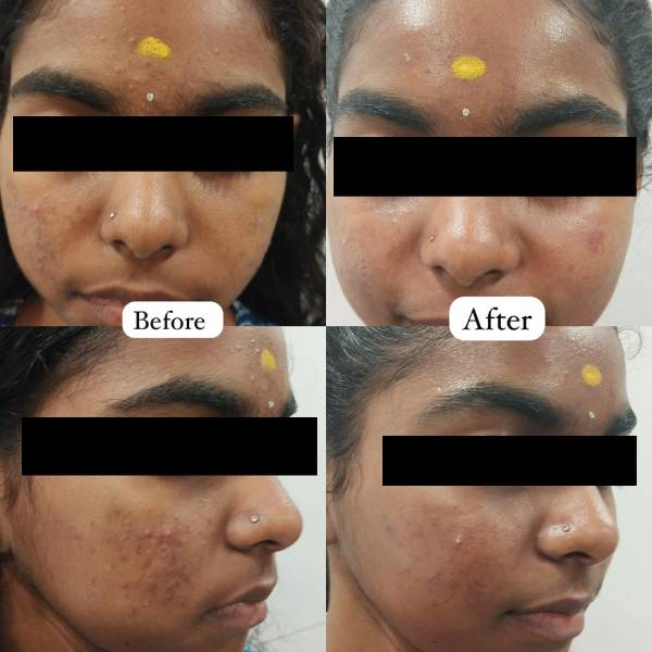 before-after-5 (1)