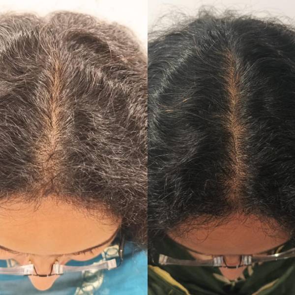 before-after-5