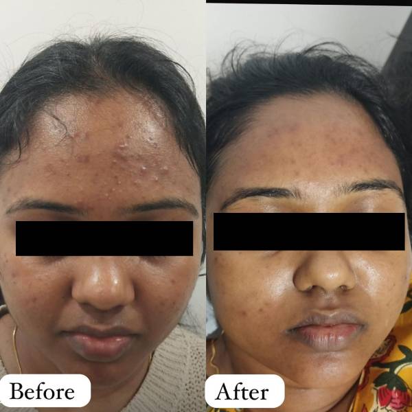 before-after-7