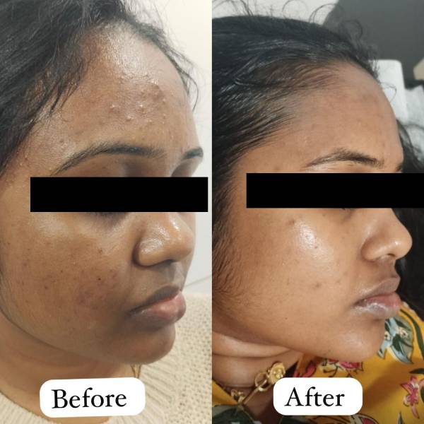before-after1
